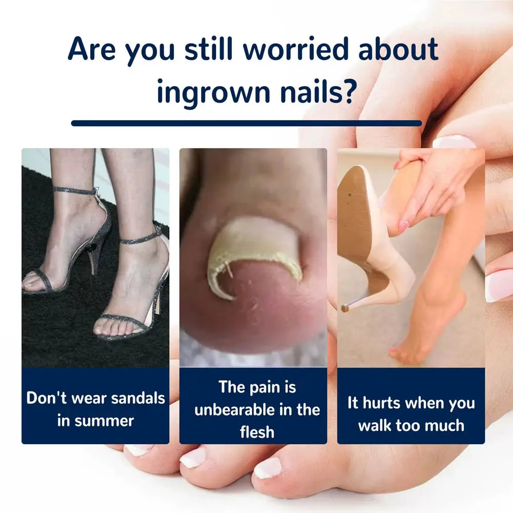 50Pcs Nail Correction Stickers Ingrown Toenail Corrector Patch Waterproof Paronychia Treatment Recover Corrector Pedicure Tool